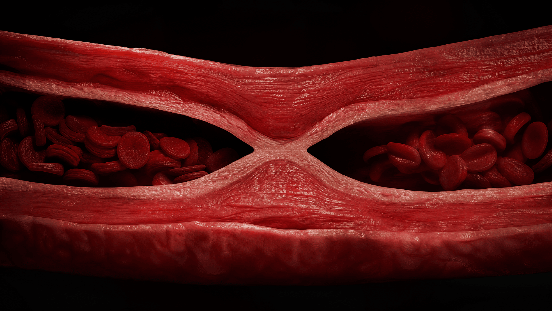 Reduced blood flow